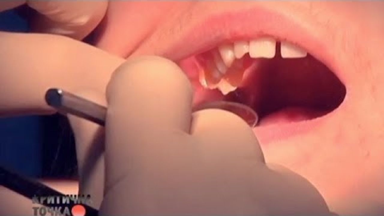 Халатность стоматологов - как&#8230;